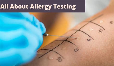 is allergy testing dangerous